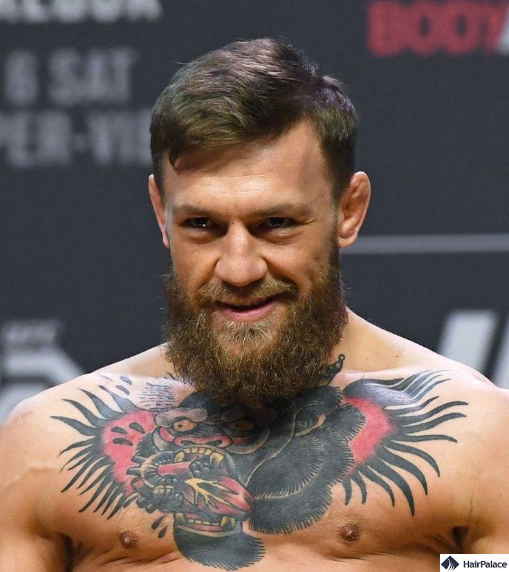 McGregors Bald Spot: Is the UFC Star Facing Hair Loss?