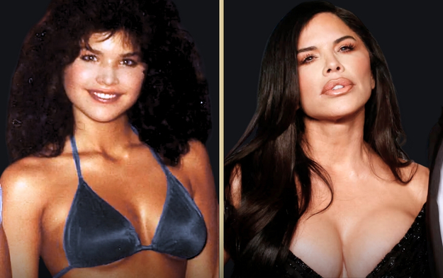 Lauren Sanchez Breast Augmentation: What You Need to Know