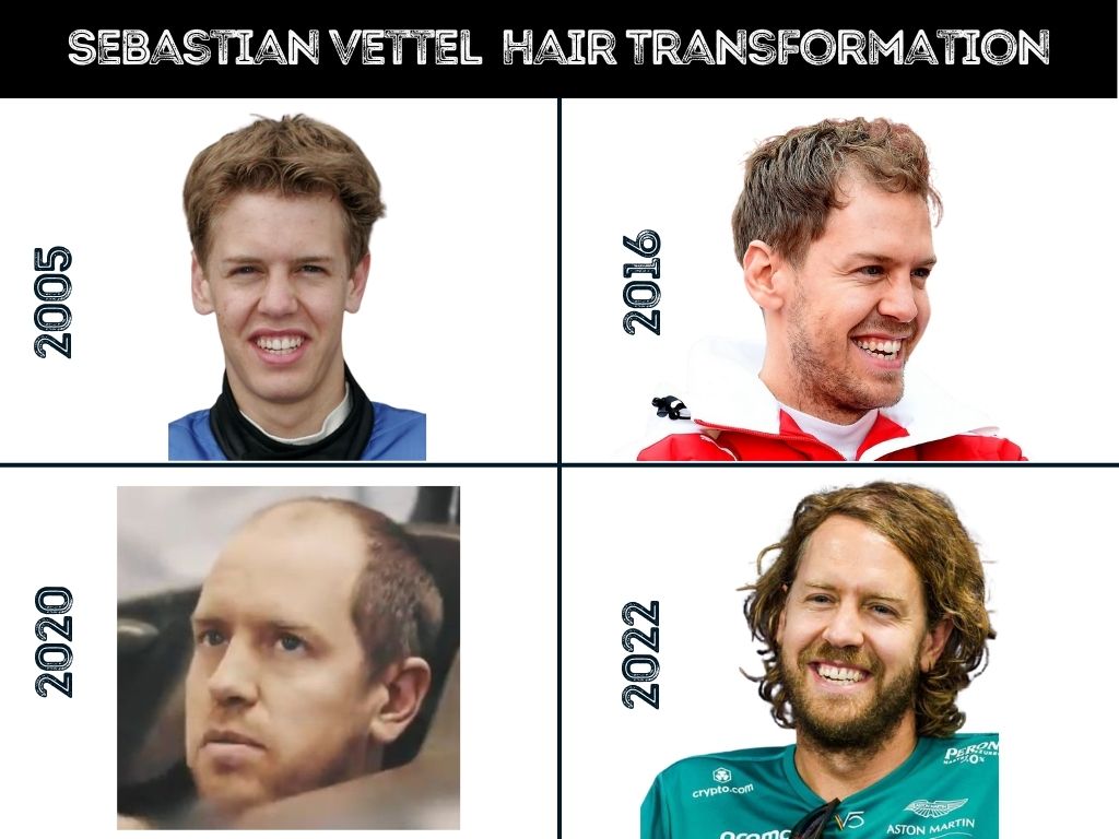 Sebastian Vettels Hair Journey: From Thick Curls to His Aston Martin Look