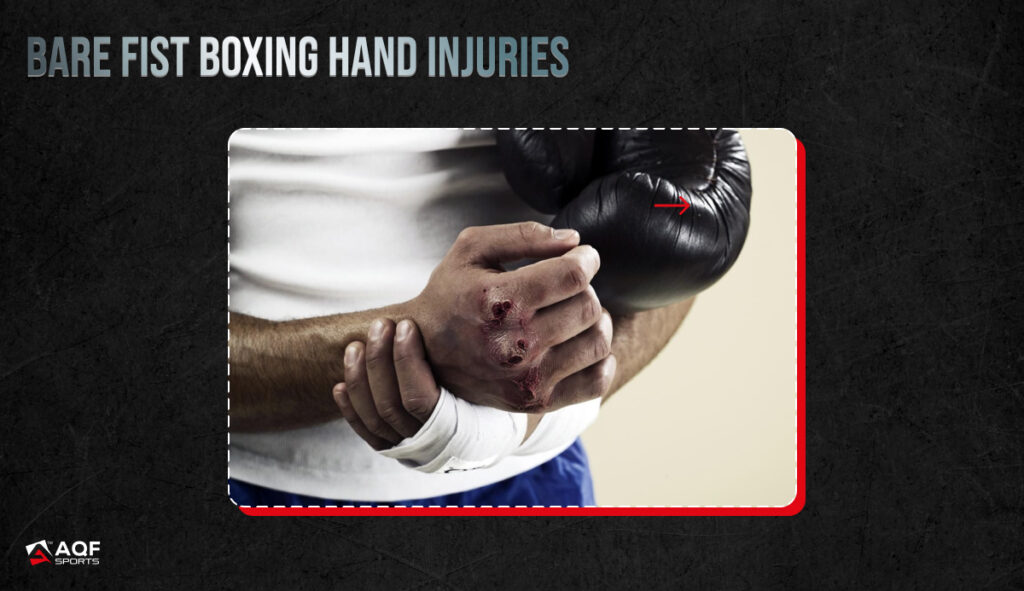 Do boxing gloves hurt your hands (discover the impact on your knuckles and joints)